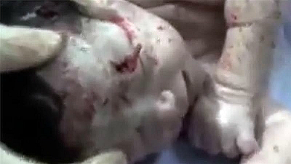 syria shrapnel baby 2